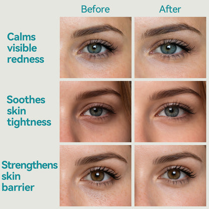 Shield Energy Hydrogel Under Eye Patches