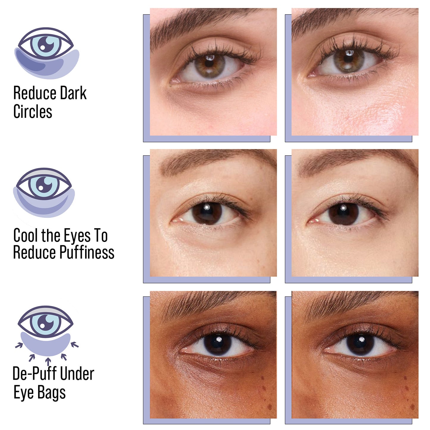 'Sirius'ly Bright Hydrogel Eye Patches