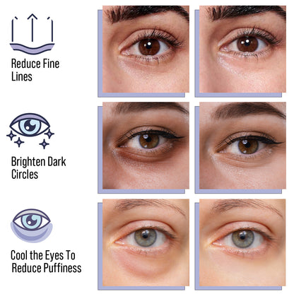 Diamond Gaze Hydrogel Eye Patches